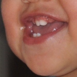 Comment soulager la poussée dentaire des premières dents de bébé?